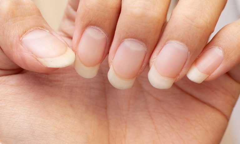 From Brittle to Beautiful: 24 Tips for Strong and Healthy Nails