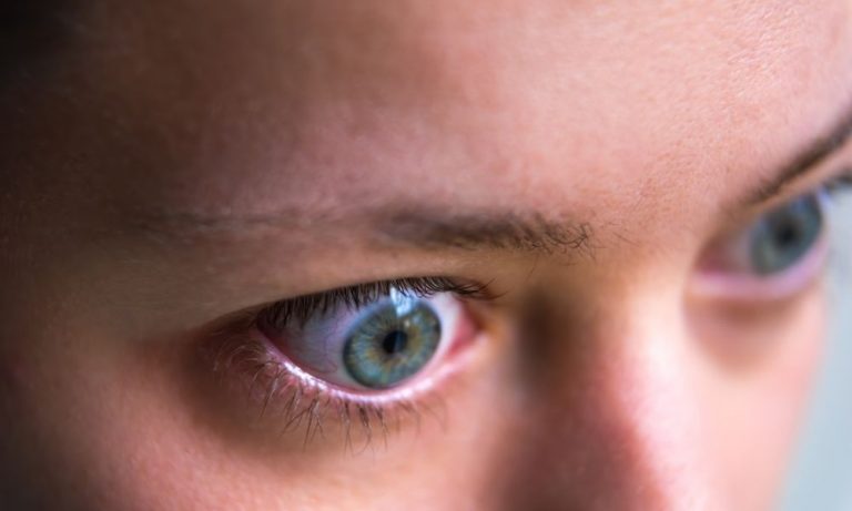 Popping Eyes: Causes, Symptoms, and Remedies