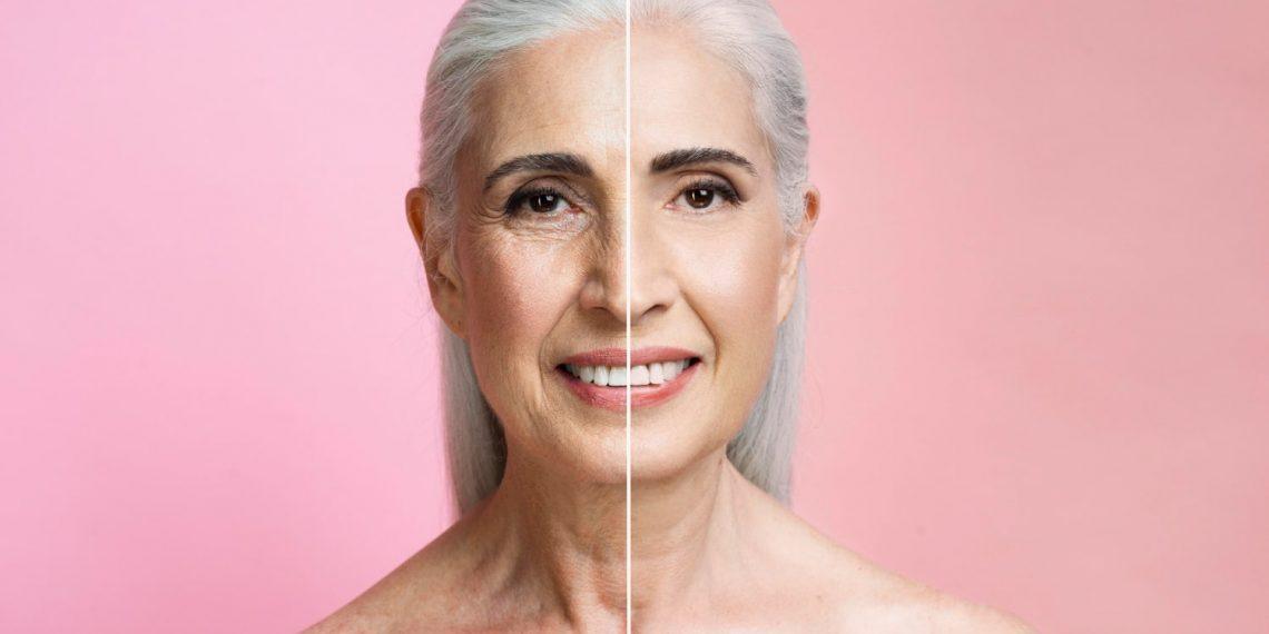 Before and after results from taking collagen peptides for skin