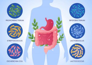 gut microbiome prevent cancer