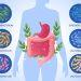 gut microbiome prevent cancer