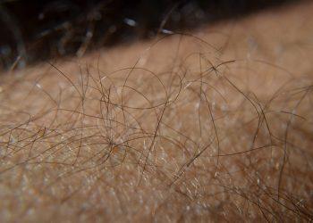 10 Proven Remedies for Thicker Hair Growth Fast!