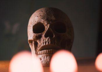 7 Essential Nutrients for Stronger Bones Today!