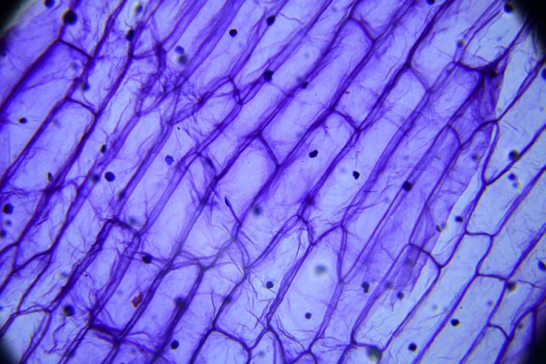 7 Natural Ways to Soothe Your Bladder Today