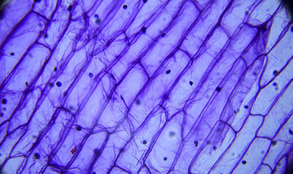 7 Natural Ways to Soothe Your Bladder Today