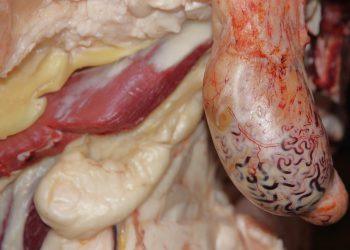 7 Secrets to Sustainable Fat Loss You Need to Know