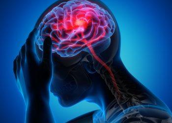 7 Surprising Natural Remedies for Migraine Relief