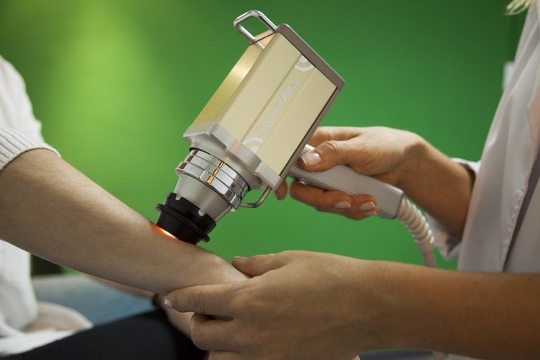 Laser treatment on patient’s arm by medical professional.
