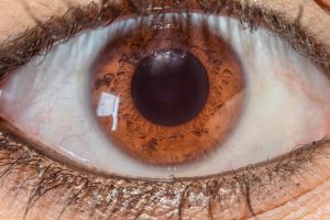 Close-up of a brown eye highlighting intricate iris patterns.