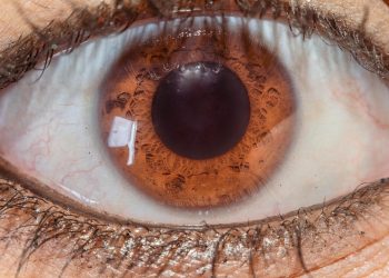 Close-up of a brown eye highlighting intricate iris patterns.