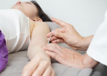Acupuncture session with needles gently placed on a woman's arm.