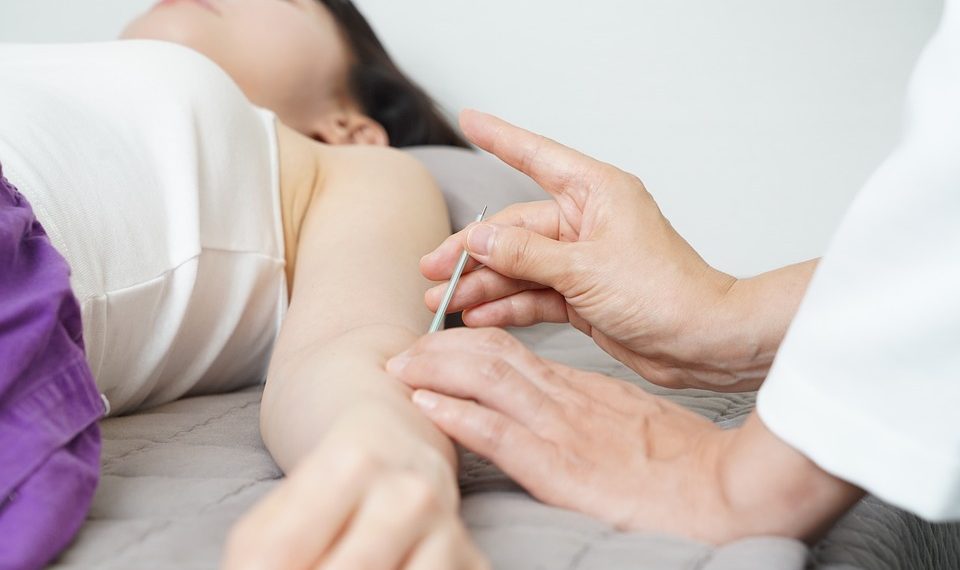 Acupuncture session with needles gently placed on a woman's arm.