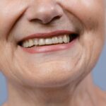 A detailed close-up of a senior woman's smile showcasing her natural teeth and wrinkles.