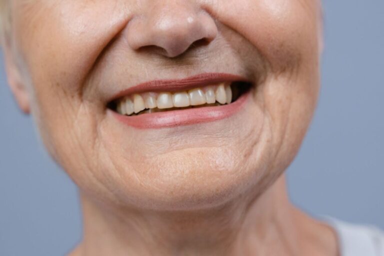 A detailed close-up of a senior woman's smile showcasing her natural teeth and wrinkles.